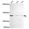 ADAP antibody, GTX16480, GeneTex, Western Blot image 