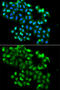 PHD Finger Protein 11 antibody, A09621, Boster Biological Technology, Western Blot image 