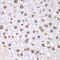 DNA topoisomerase 1 antibody, LS-C747620, Lifespan Biosciences, Immunohistochemistry paraffin image 