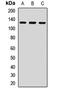 Zinc Finger E-Box Binding Homeobox 1 antibody, orb412362, Biorbyt, Western Blot image 