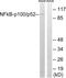 Nuclear Factor Kappa B Subunit 2 antibody, LS-B11339, Lifespan Biosciences, Western Blot image 