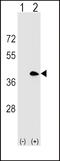 CD20 antibody, LS-C164640, Lifespan Biosciences, Western Blot image 