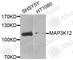 Mitogen-Activated Protein Kinase Kinase Kinase 12 antibody, A8464, ABclonal Technology, Western Blot image 