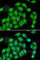 Aspartate Beta-Hydroxylase antibody, A6873, ABclonal Technology, Immunofluorescence image 