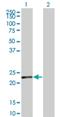 SUMO Peptidase Family Member, NEDD8 Specific antibody, H00123228-M06, Novus Biologicals, Western Blot image 