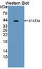 Proprotein Convertase Subtilisin/Kexin Type 5 antibody, LS-C373233, Lifespan Biosciences, Western Blot image 