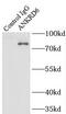 Ankyrin Repeat Domain 6 antibody, FNab00420, FineTest, Immunoprecipitation image 