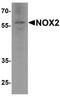 Cytochrome B-245 Beta Chain antibody, A00328-1, Boster Biological Technology, Western Blot image 