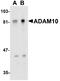 ADAM Metallopeptidase Domain 10 antibody, A00566-2, Boster Biological Technology, Western Blot image 