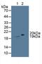 Cold Inducible RNA Binding Protein antibody, MBS2026125, MyBioSource, Western Blot image 