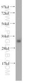 Iodotyrosine Deiodinase antibody, 16667-1-AP, Proteintech Group, Western Blot image 
