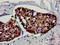 Heat Shock Transcription Factor 1 antibody, LS-C674978, Lifespan Biosciences, Immunohistochemistry paraffin image 