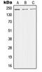 Mediator Complex Subunit 1 antibody, GTX55164, GeneTex, Western Blot image 