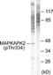 MAPK Activated Protein Kinase 2 antibody, TA312935, Origene, Western Blot image 