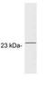 Guanylate Cyclase Activator 1A antibody, GTX25420, GeneTex, Western Blot image 