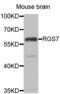 Regulator Of G Protein Signaling 7 antibody, PA5-77000, Invitrogen Antibodies, Western Blot image 