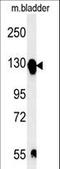 Integrin Subunit Alpha 5 antibody, LS-C165315, Lifespan Biosciences, Western Blot image 