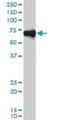 Origin Recognition Complex Subunit 2 antibody, H00004999-M01, Novus Biologicals, Western Blot image 