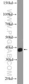 Mitochondrial RRNA Methyltransferase 1 antibody, 16392-1-AP, Proteintech Group, Western Blot image 