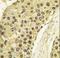 Cyclin A2 antibody, LS-C100874, Lifespan Biosciences, Immunohistochemistry paraffin image 