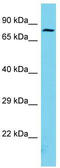 Armadillo Repeat Containing 9 antibody, TA330768, Origene, Western Blot image 