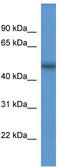 Sec1 Family Domain Containing 2 antibody, TA338870, Origene, Western Blot image 