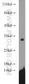 Succinate Dehydrogenase Complex Iron Sulfur Subunit B antibody, 10620-1-AP, Proteintech Group, Western Blot image 