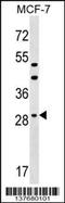 Dehydrogenase/Reductase 11 antibody, 59-521, ProSci, Western Blot image 