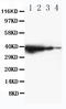 Toll Like Receptor Adaptor Molecule 1 antibody, LS-C313133, Lifespan Biosciences, Western Blot image 