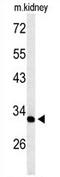 Transmembrane And Ubiquitin Like Domain Containing 2 antibody, AP54303PU-N, Origene, Western Blot image 