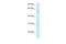 SMG9 Nonsense Mediated MRNA Decay Factor antibody, A10233, Boster Biological Technology, Western Blot image 