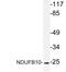 NADH:Ubiquinone Oxidoreductase Subunit B10 antibody, LS-C177384, Lifespan Biosciences, Western Blot image 