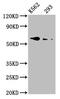 Bone Morphogenetic Protein Receptor Type 1A antibody, CSB-PA002748LA01HU, Cusabio, Western Blot image 