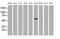 Glucosylceramidase Beta 3 (Gene/Pseudogene) antibody, MA5-25471, Invitrogen Antibodies, Western Blot image 