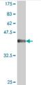 Mediator of RNA polymerase II transcription subunit 12 antibody, H00009968-A01, Novus Biologicals, Western Blot image 