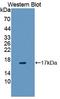 Vasoactive Intestinal Peptide Receptor 1 antibody, LS-C374599, Lifespan Biosciences, Western Blot image 