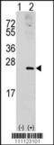 Rac Family Small GTPase 1 antibody, 63-008, ProSci, Western Blot image 