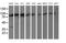 Proteasome 26S Subunit, Non-ATPase 2 antibody, MA5-25637, Invitrogen Antibodies, Western Blot image 