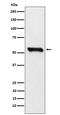 Dihydrolipoamide Dehydrogenase antibody, M00870-2, Boster Biological Technology, Western Blot image 