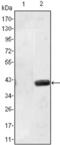 Matrilin 1 antibody, abx011948, Abbexa, Enzyme Linked Immunosorbent Assay image 