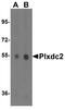 Plexin Domain Containing 2 antibody, A08798, Boster Biological Technology, Western Blot image 