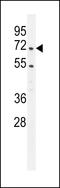 Coactivator Associated Arginine Methyltransferase 1 antibody, MBS9203220, MyBioSource, Western Blot image 