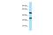 Calsequestrin 2 antibody, A02940, Boster Biological Technology, Western Blot image 