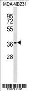 Hes Related Family BHLH Transcription Factor With YRPW Motif Like antibody, 58-862, ProSci, Western Blot image 