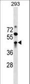Zinc Finger And BTB Domain Containing 32 antibody, LS-C160722, Lifespan Biosciences, Western Blot image 