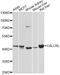 Calcitonin Receptor Like Receptor antibody, STJ111275, St John