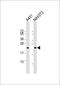 RAS Related 2 antibody, M04117-1, Boster Biological Technology, Western Blot image 