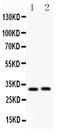 Interleukin 1 Beta antibody, PA1533, Boster Biological Technology, Western Blot image 