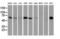 Epsin 2 antibody, LS-C786889, Lifespan Biosciences, Western Blot image 