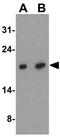 Immunity Related GTPase M antibody, GTX85039, GeneTex, Western Blot image 